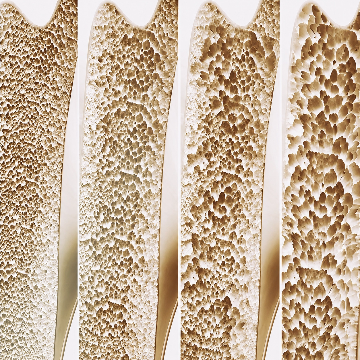 Osteopore Bioresorbable Implants